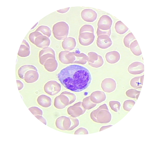 WBC_case_sim_simulatorspage